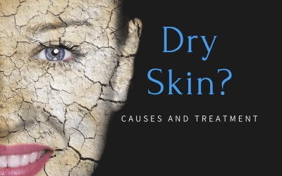 The Common Causes of Dry Skin and How to Treat It