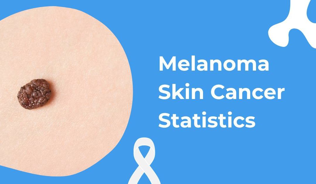 Melanoma Skin Cancer Statistics